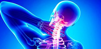 Шийний остеохондроз — головні ознаки і народні методи лікування