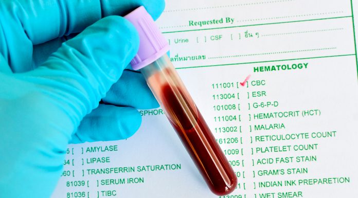 Загальний аналіз крові: аналізуємо свої показники без доктора