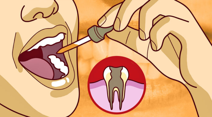 Як зняти гострий зубний біль, коли дантист не доступний