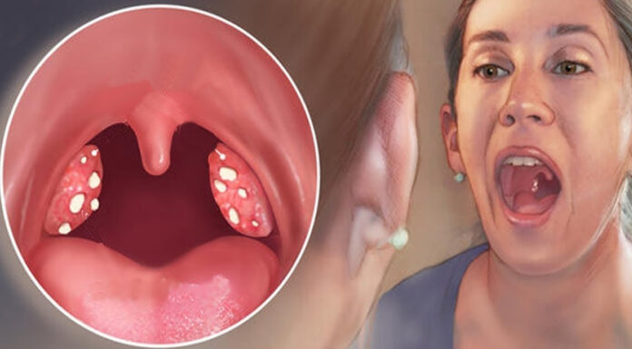 Олія, яка допомагає перемагати хвороби! Дивовижний засіб проти застуди, ангіни та кашлю