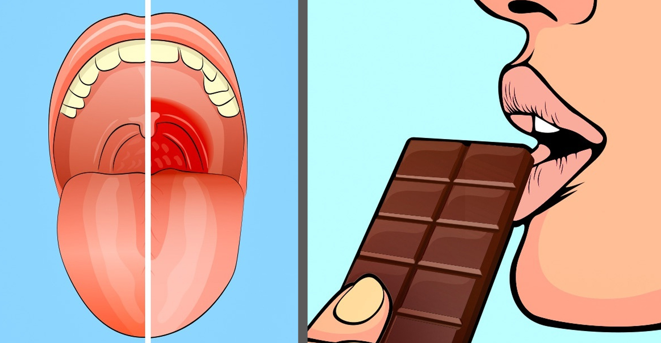 Можно ли мороженое при боли в горле. Болит горло от шоколада.