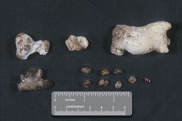 princ_rm_photo_of_sizes_of_kidney_stones.jpg?resize=375px:250px&output-quality=50