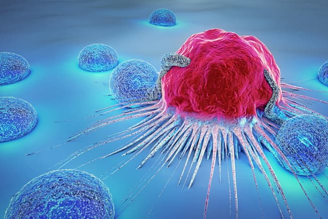 Tumor