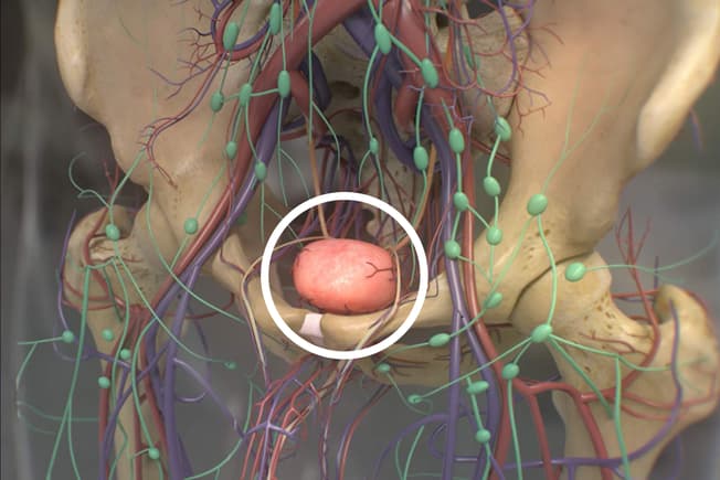 Prostate