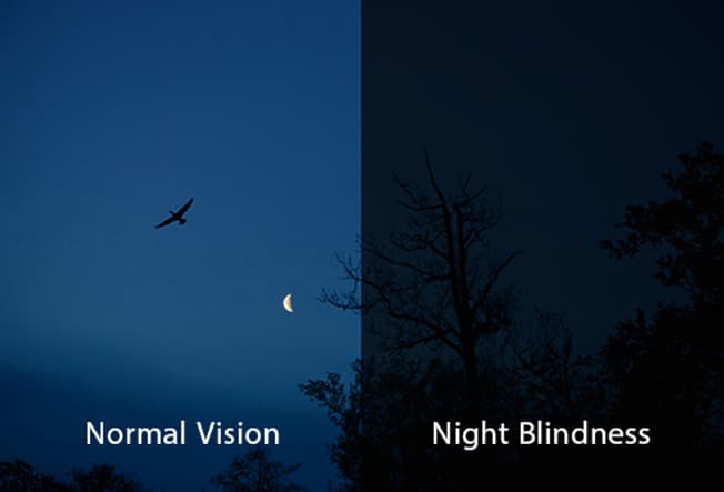 Night Blindness